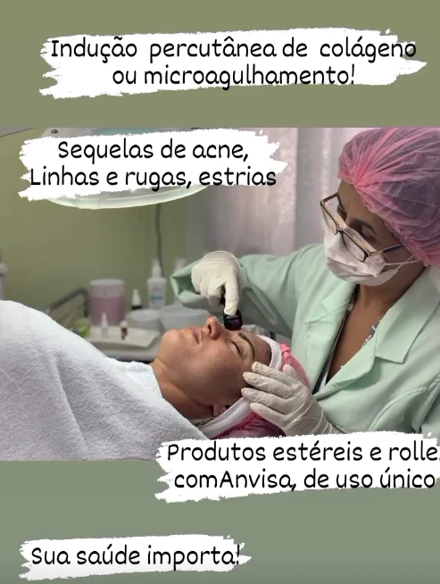 Rose Mary realizando microagulhamento com materiais de uso único