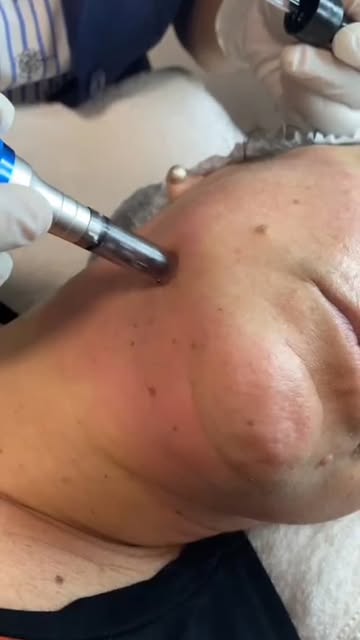 Procedimento facial realizado no espaço Rose Mary